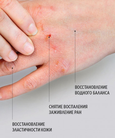 SMART   Умный бальзам для быстрого восстановления кожи  HEALING BALM   15мл